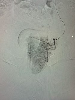 radiologie interventionnelle