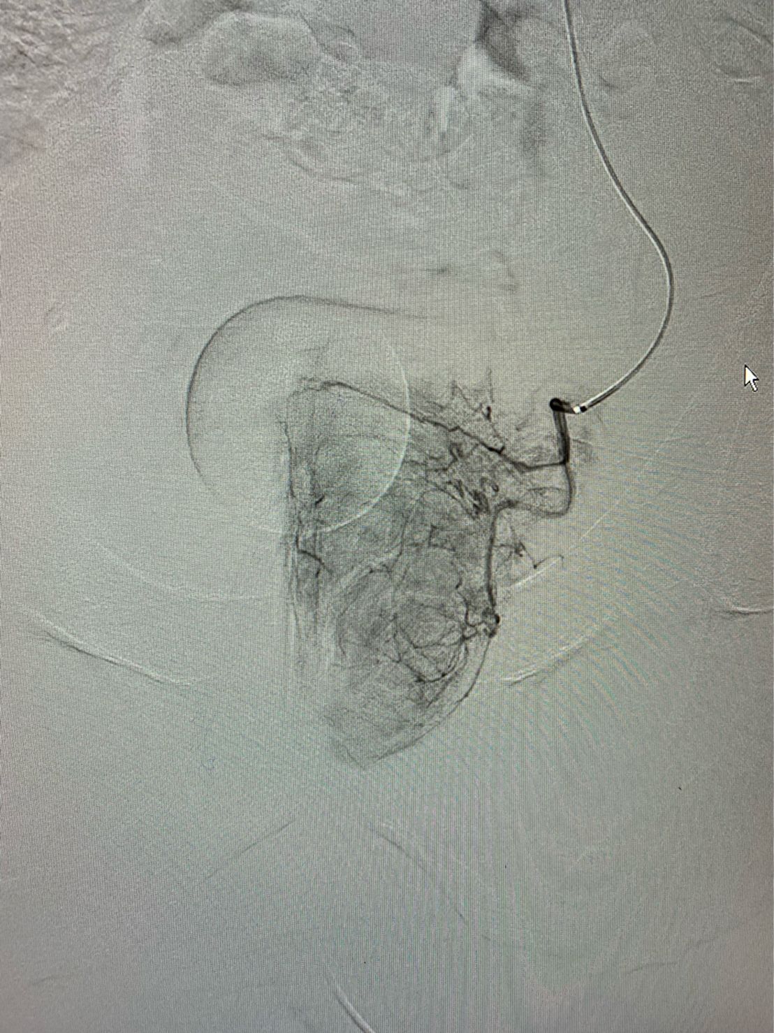 radiologie interventionnelle