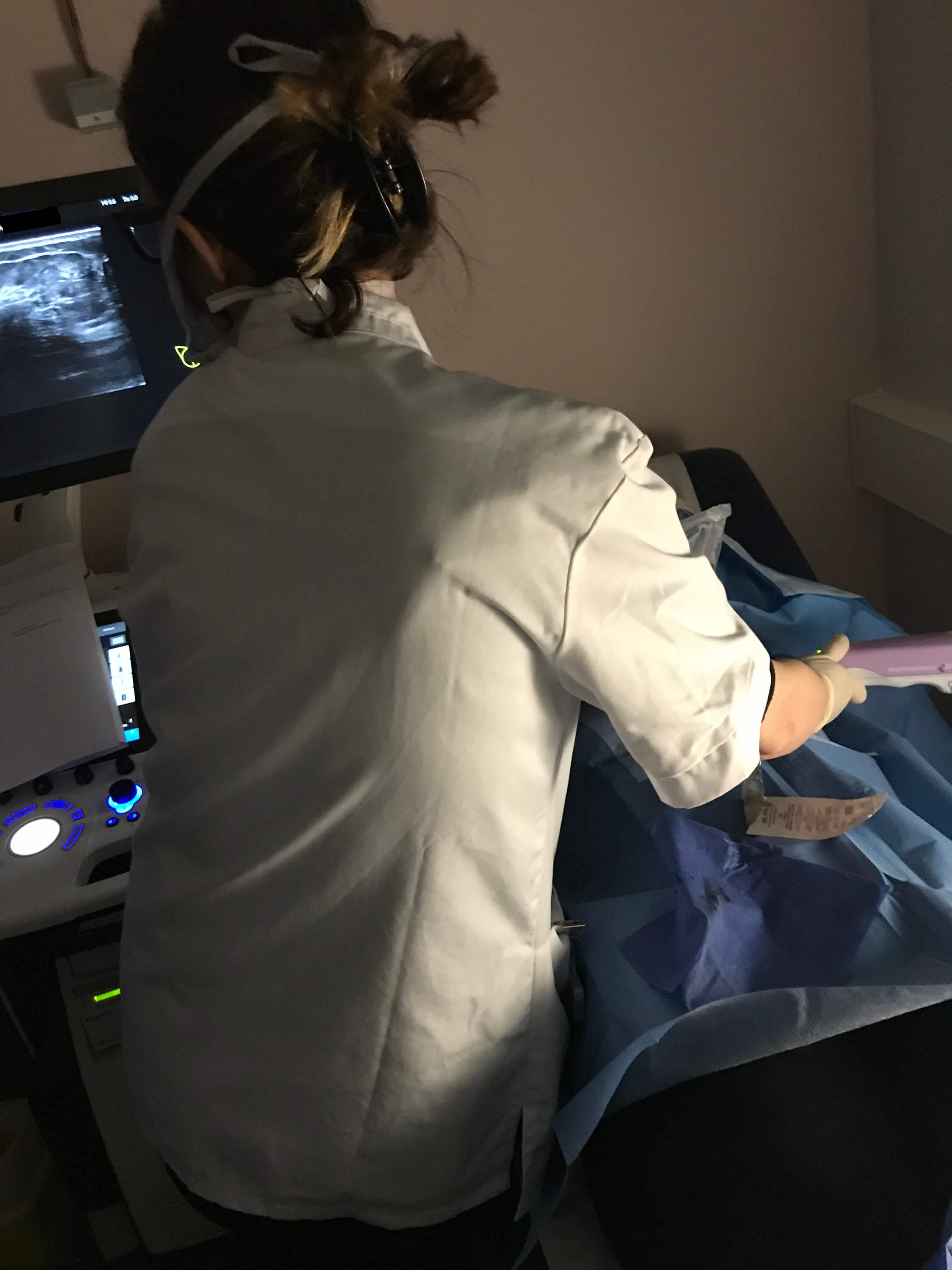 Macro Biopsie Mammaire en routine à Imapôle Lyon-Villeurbanne